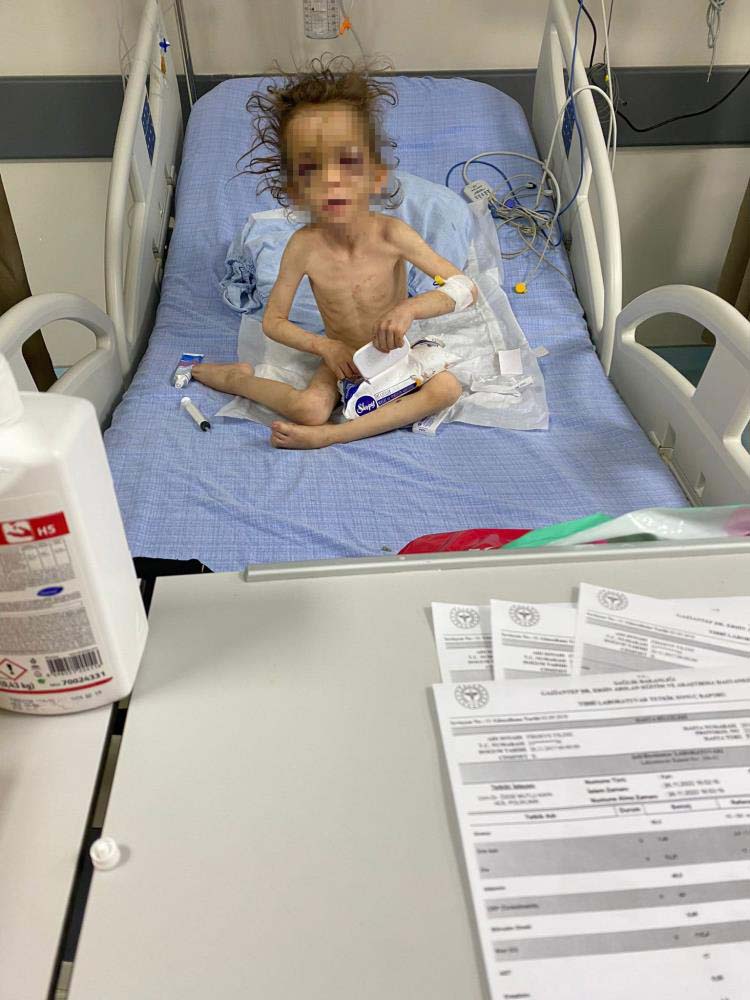 Senin gibi anne olmaz olsun! Gaziantep'te yürek yakan olay: 5 yaşındaki çocuğunu aç susuz bırakıp...