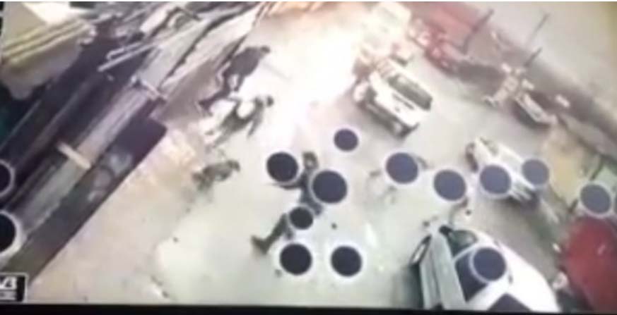 İstanbul Eyüpsultan'da Pitbull dehşeti! 10 yaşındaki çocuk canını zor kurtardı!