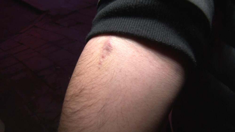 İstanbul Esenyurt'ta kan donduran olay! Böbrek ağrısı için gittiği hastaneden madde bağımlısı olup çıktı!