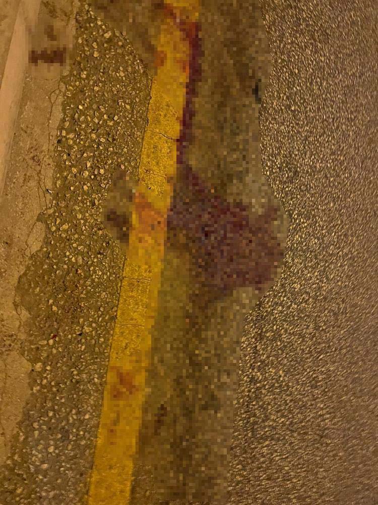 Ankara'da feci kaza! Yolun karşısına geçmeye çalışıyordu peş peşe gelen iki araç ...