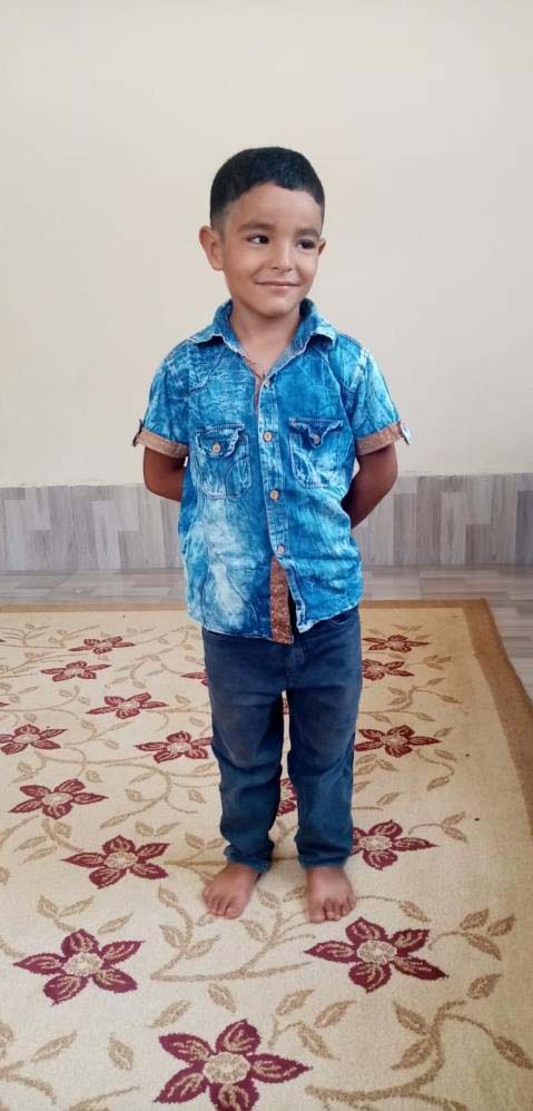 Gaziantep'te sokak köpeği dehşeti! 6 yaşındaki çocuk ölmekten son anda kurtuldu!