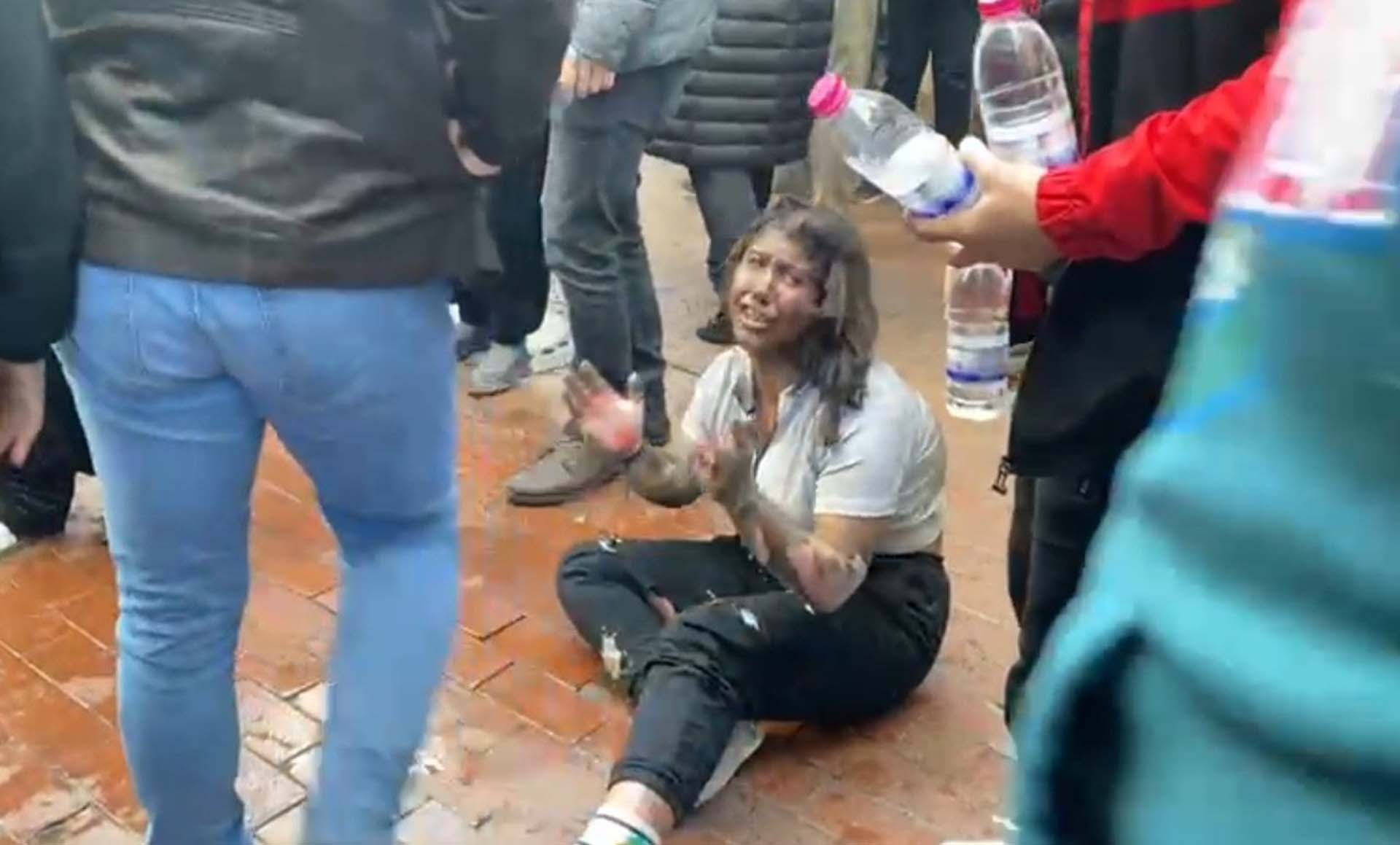 Aydın Nazilli'deki restoran patlamasından yaralı kurtulmuştu! Genç kızdan acı haber... 