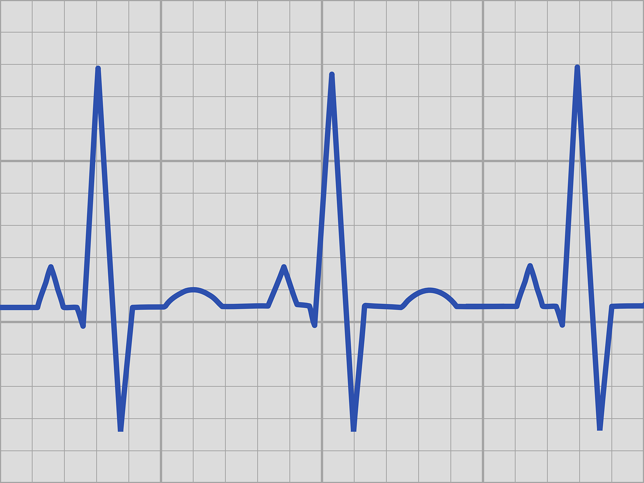 EKG nedir? EKG Neden ve nasıl çekilir ? 
