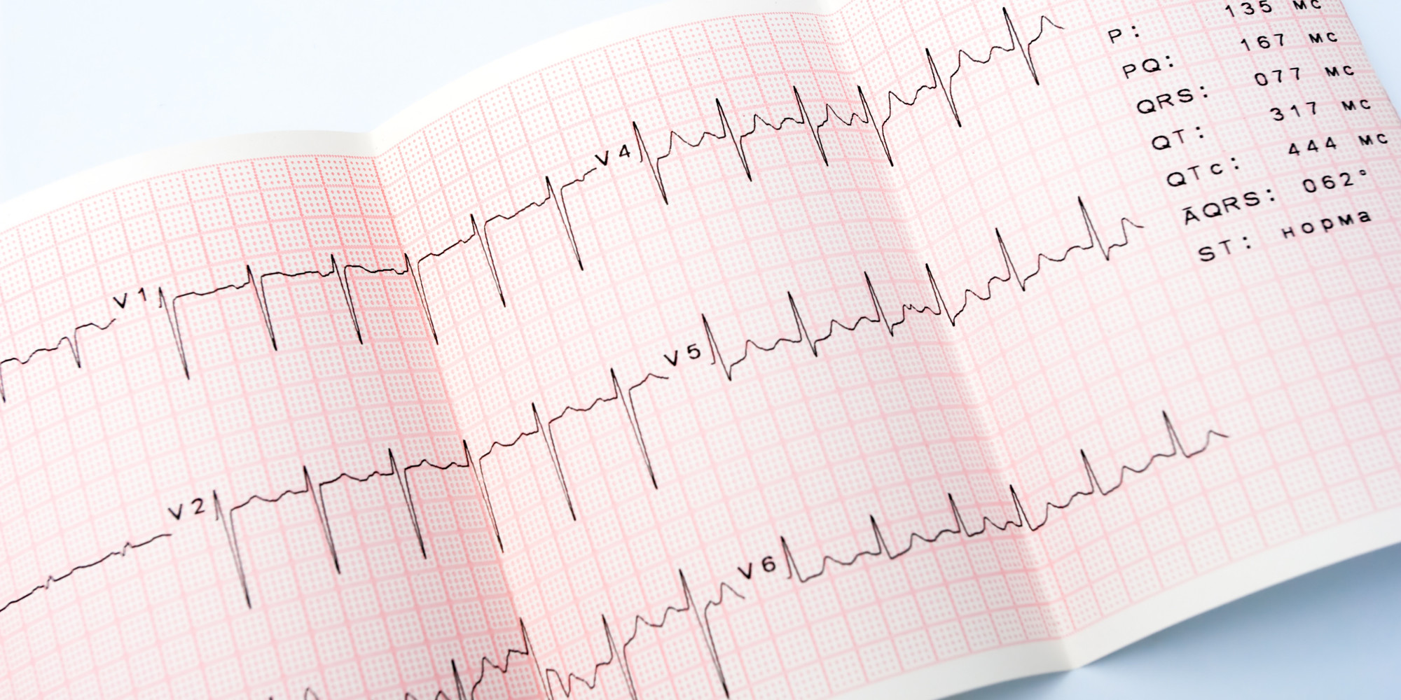 EKG nedir? EKG Neden ve nasıl çekilir ? 