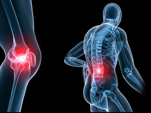 Osteoartrit Nedir? Belirtileri, Nedenleri ve Tedavi Yöntemleri Nelerdir?