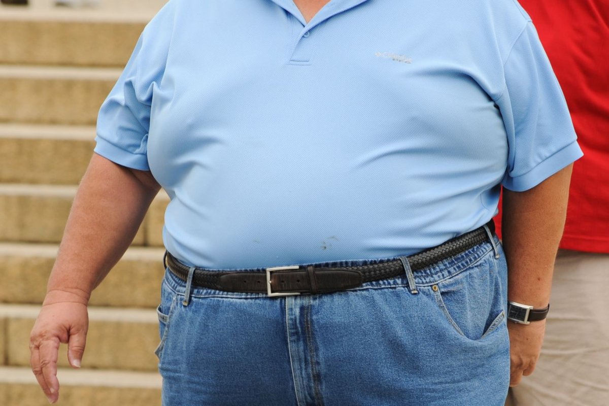  "Morbid obezite" cerrahisinin ardından, hayata yeniden geldi!