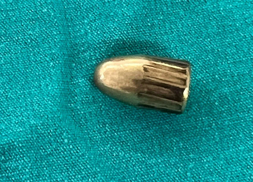 Annesi arı soktu zannetti! Gerçek ortaya çıkınca şok oldu!