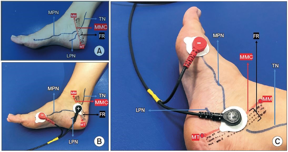 PAÜ Tıp Fakültesi İdrar kaçırmada dünyada ilk olacak tedavi yöntemi geliştirdi