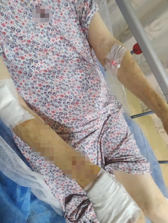 Büyükçekmece'de maymun kabusu! Sahibinden kaçtı, 3 kişiyi yaraladı! Polis harekete geçti!