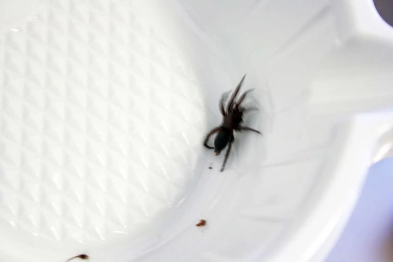 Kulağından canlı örümcek çıktı: "Hışırtı yapan meğerse örümcekmiş"