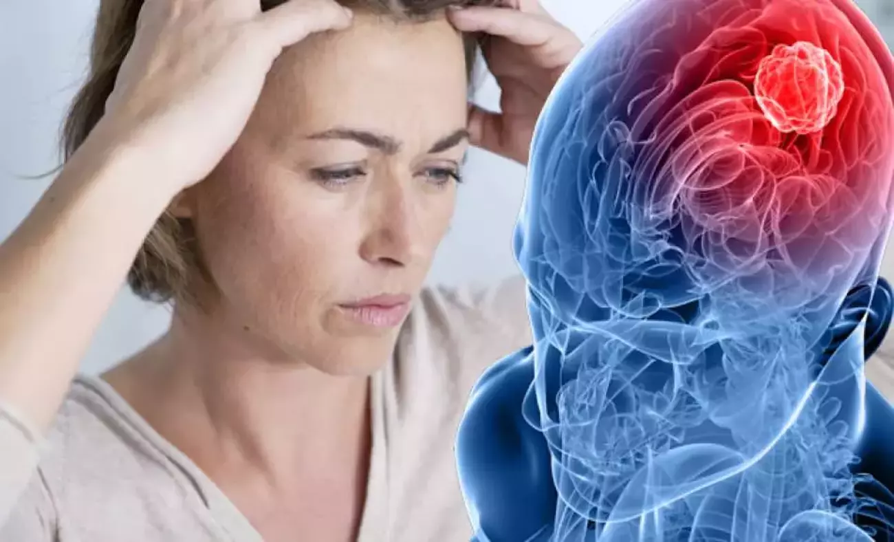Uzmanlar uyardı: Sadece baş ağrısı sananlar dikkat! Beyin tümörü belirtisi olabilir