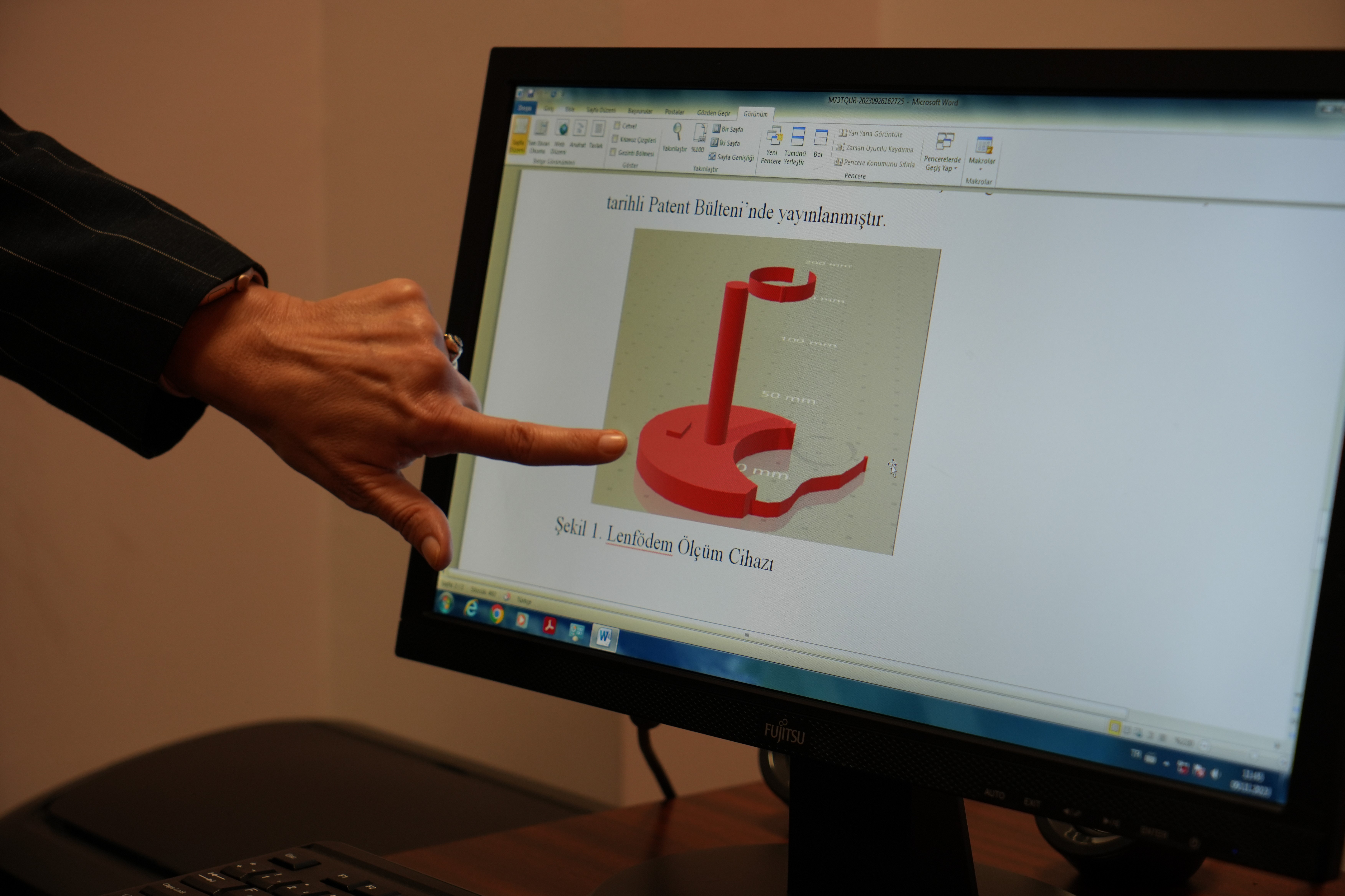 Bu cihaz lenfödeminin erken teşhisine imkan sağlayacak!