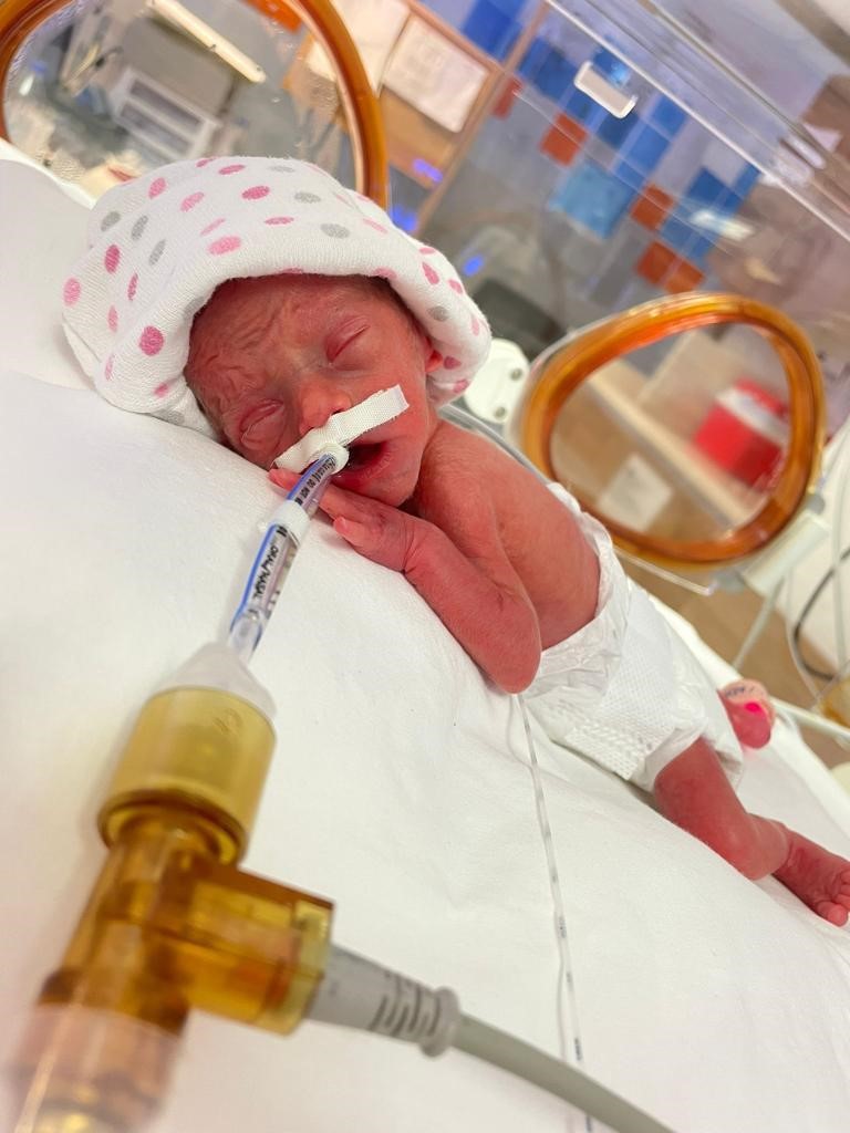 500 gram doğan Nisa bebeğin son halini görenler şaşkınlıklarını gizleyemedi