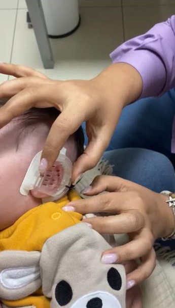  Kulaklardaki şekil bozukluğu sizi üzmesin! Tedavide bu yöntem işe yarıyor?