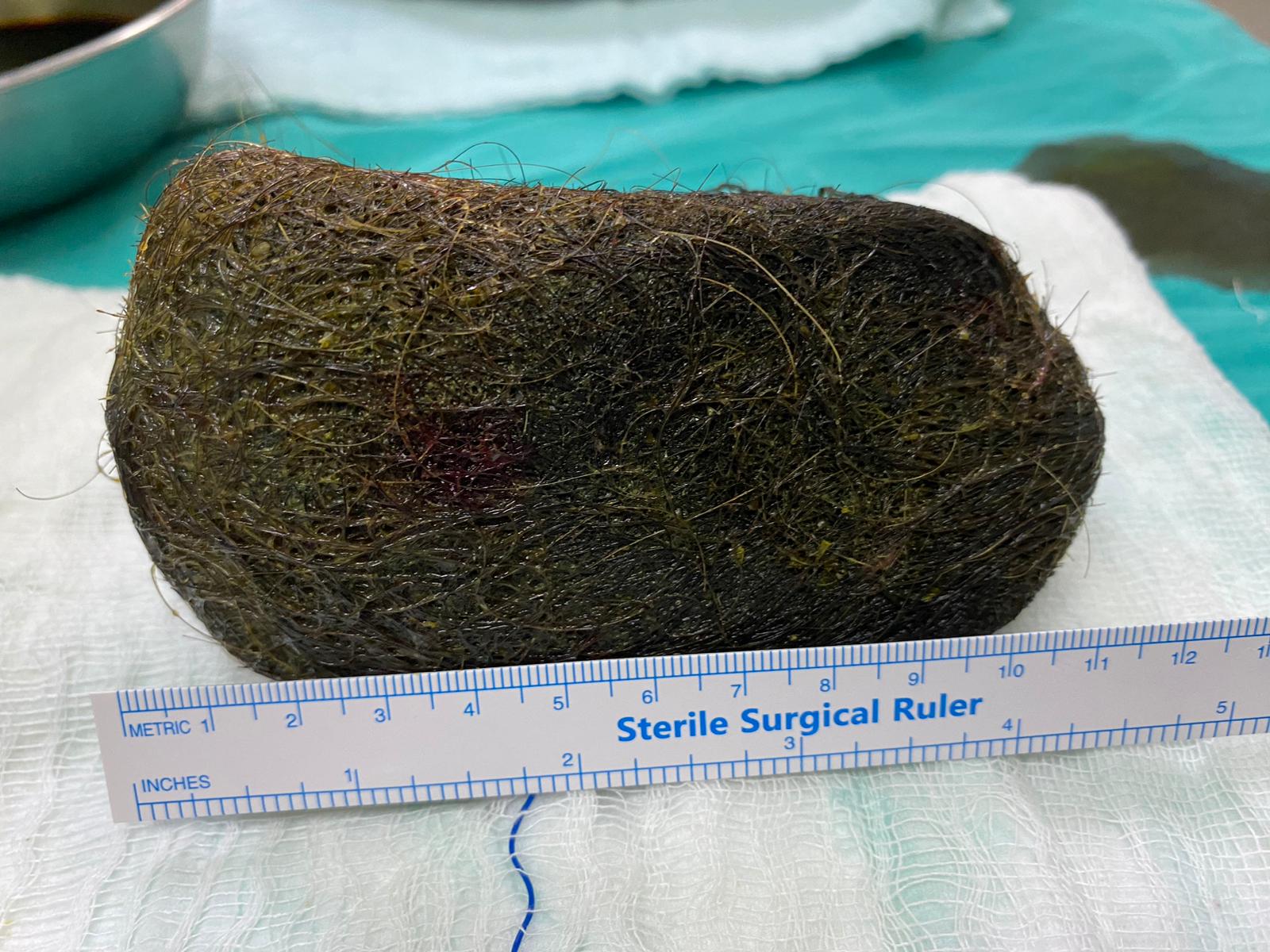 Osmaniye'de şaşkınlık yaratan olay! Karın ağrısı ile hastaneye giden hastanın mide ve bağırsağından bakın ne çıktı!