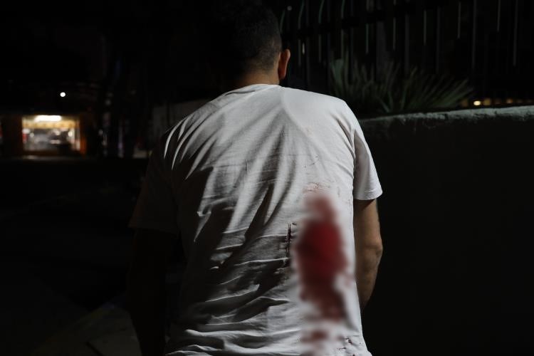 Taksici vahşeti bitmiyor! Mesaisi biten taksici “Aracımı kapattım” diyince, müşteri sırtına makas sapladı!