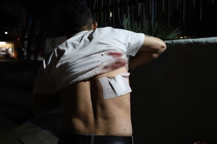 Taksici vahşeti bitmiyor! Mesaisi biten taksici “Aracımı kapattım” diyince, müşteri sırtına makas sapladı!