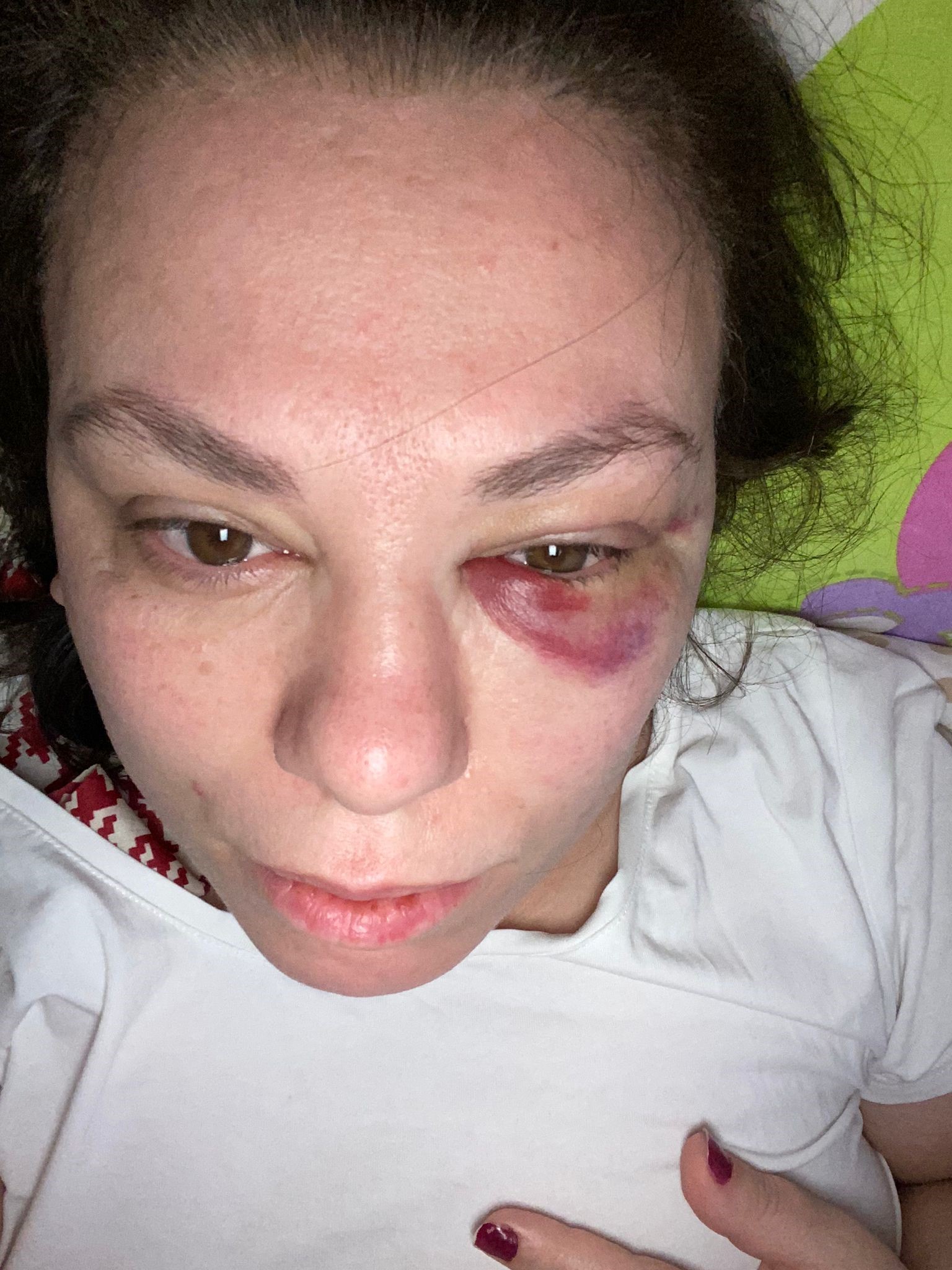 Otobüste, ayağı ağrıyan kadın yer istedi, gözüne yumruğu yedi!