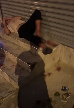 Adana'da korkunç gece! Evden kaçan pitbull cinsi köpek, onu yakalamak isteyen sahibine saldırıdı!