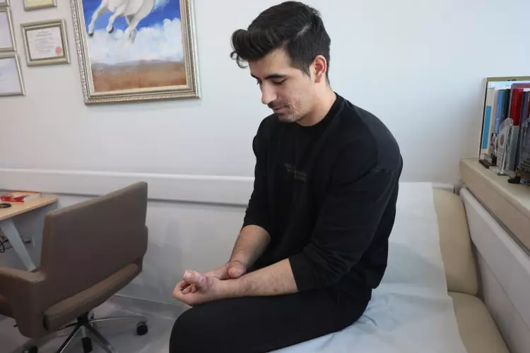 350 tonluk presin kopardığı parmakların yerine ayak parmakları dikildi