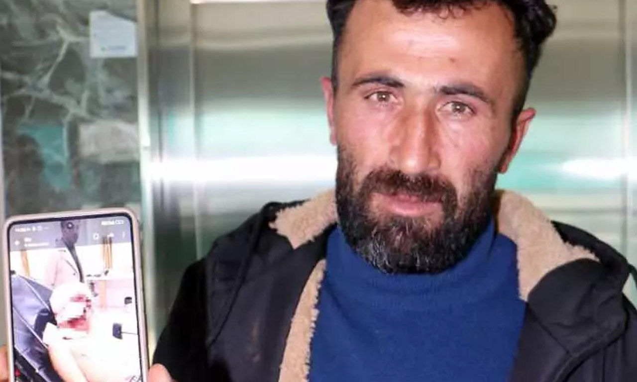 Erzurum'de dehşet: Bir küçük can daha başıboş köpeklerin pençeleriyle parçalandı! 