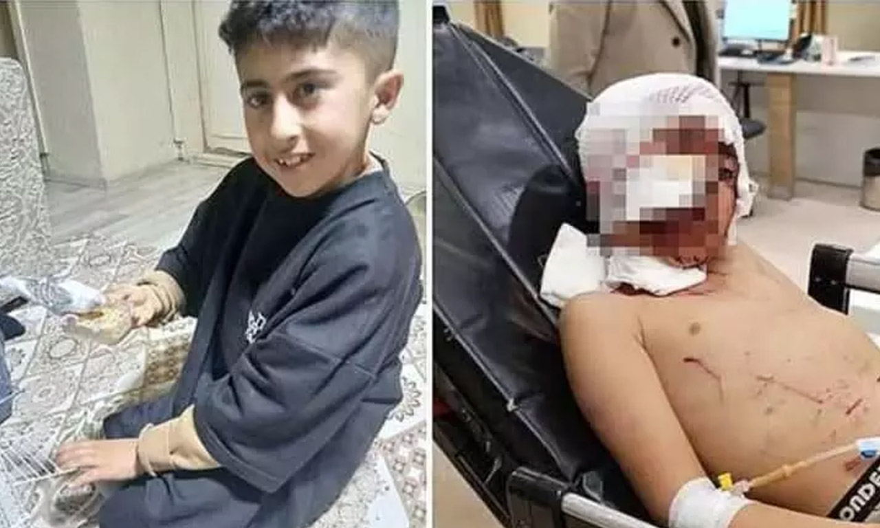 Erzurum'de dehşet: Bir küçük can daha başıboş köpeklerin pençeleriyle parçalandı! 
