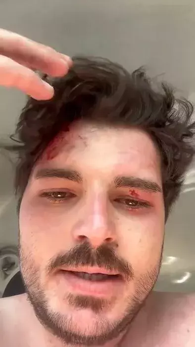 Ünlü oyuncu trafikte 4 kişi tarafından ölesiye dayak yedi: Kamyoncu araya girmeseydi ölecektim!