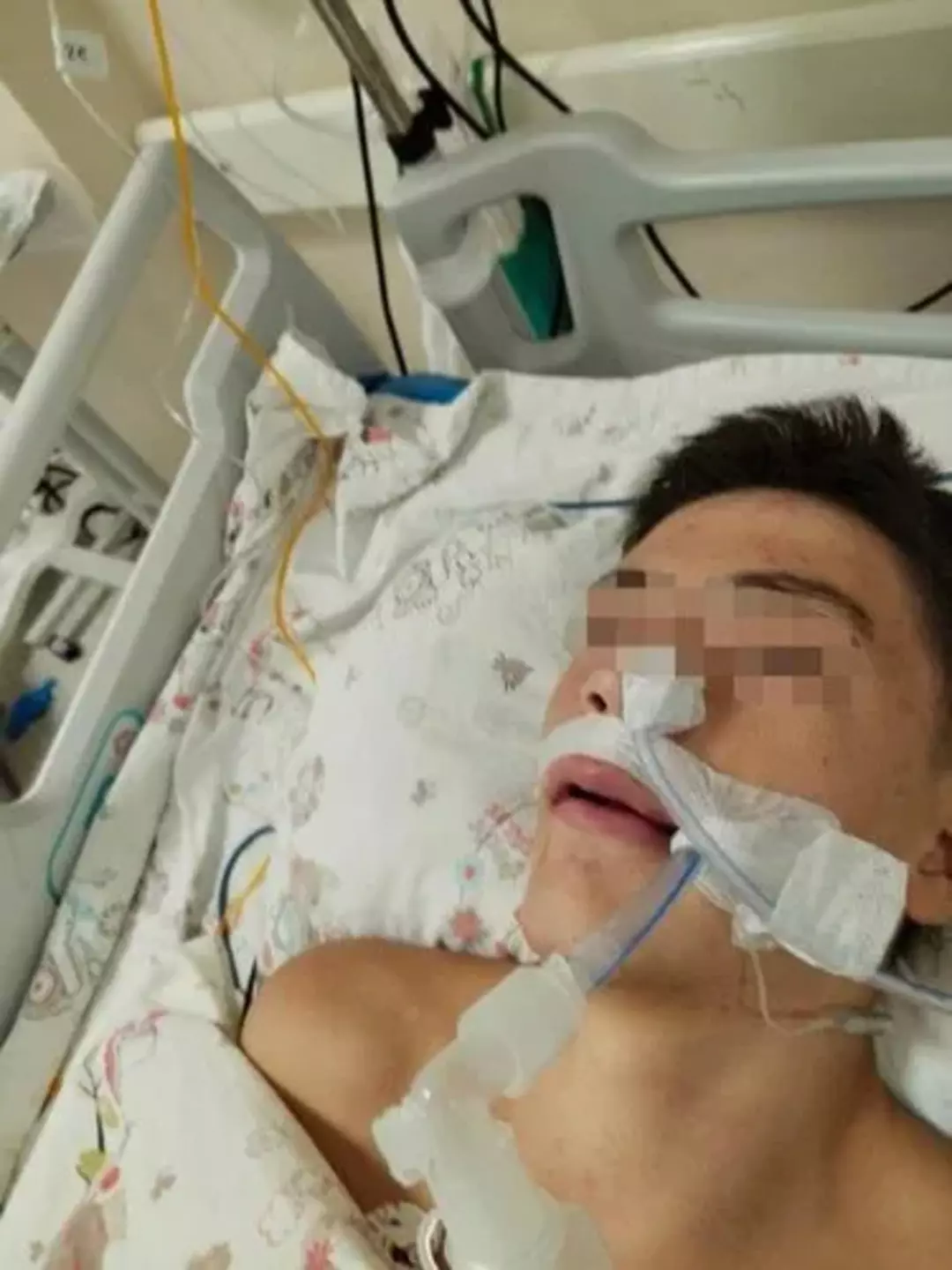 Akran zorbalığı komaya soktu: İşte şaşkına çeviren gerekçe!