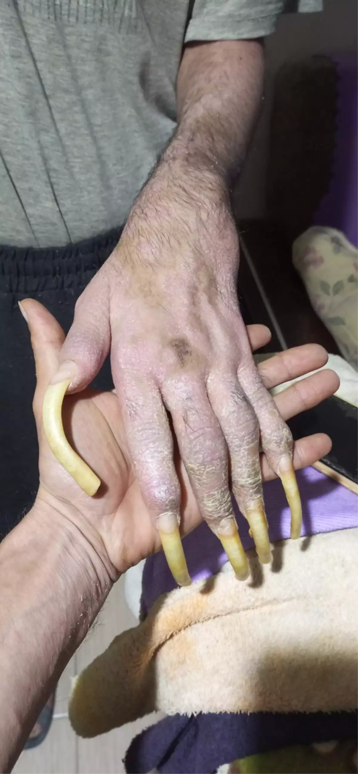 Telefon bağımlısı genç gündem oldu: 3 yıldır duş bile almadım, elimde olsa tuvalete de gitmem, yemek de yemem...