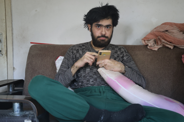 Telefon bağımlısı genç gündem oldu: 3 yıldır duş bile almadım, elimde olsa tuvalete de gitmem, yemek de yemem...