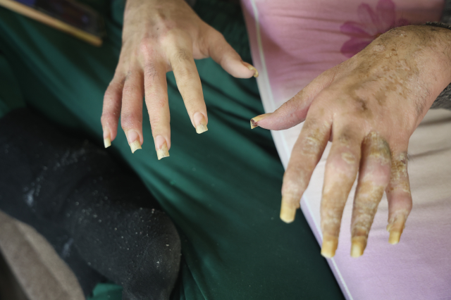 Telefon bağımlısı genç gündem oldu: 3 yıldır duş bile almadım, elimde olsa tuvalete de gitmem, yemek de yemem...