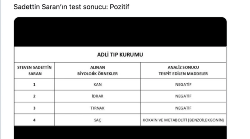 Fenerbahçe kulübü başkanı Sadettin Saran'ın uyuşturucu testi pozitif çıktı
