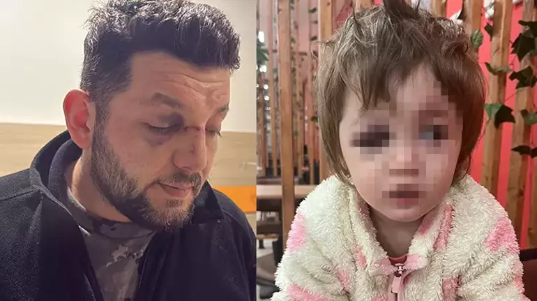 Yalova'da baba ve kıza saldıran o cani komşu için istenen ceza belli oldu!