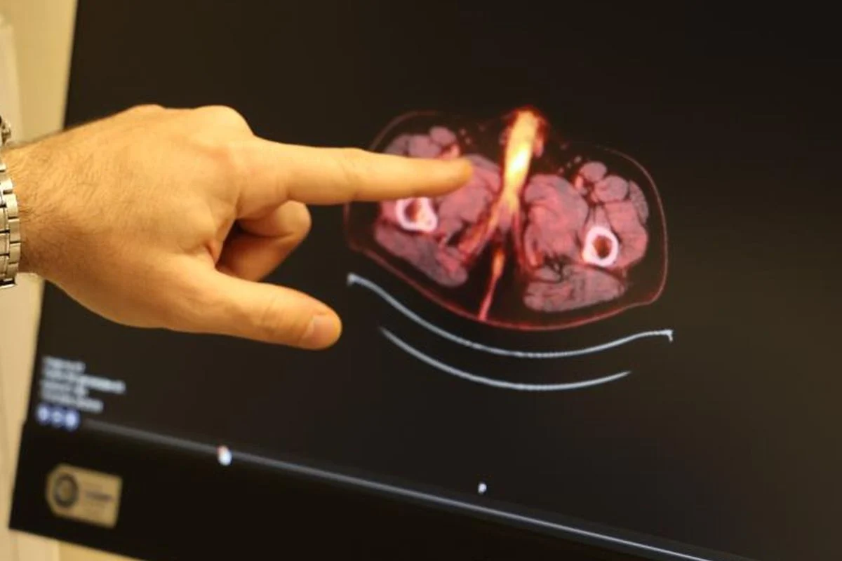 Tıp literatürüne giren son isim: Diyarbakırlı gencin penisi alındı!