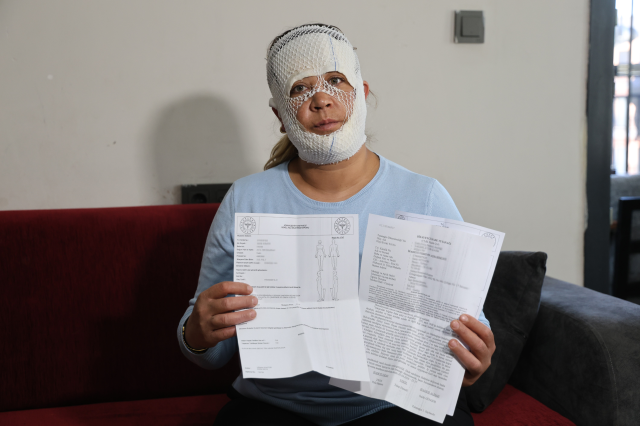 Yaptırdığı "Prenses cilt bakımı" yüzünü öyle bir hale soktu ki: Oğlum bana "öcü" diyor!