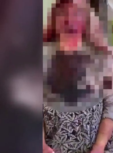 Bu nasıl evlat! 85 yaşındaki annesini sopayla döve döve tanınmaz hale getirdi!