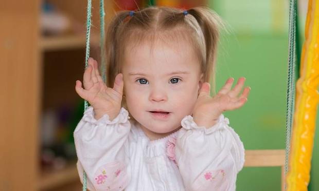 Down sendromu nedir? | Down sendromu genetik mi?