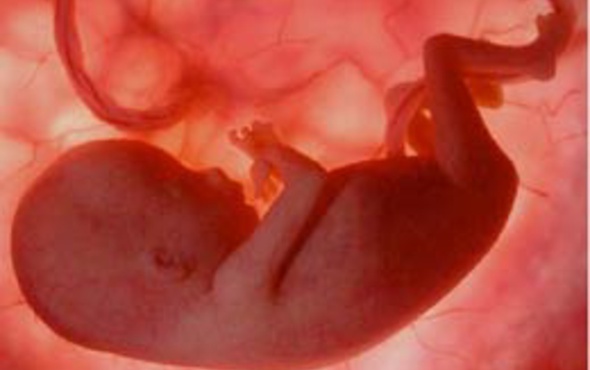 Sarhoş hemşire doğumda bebeğin kafasını kopardı!