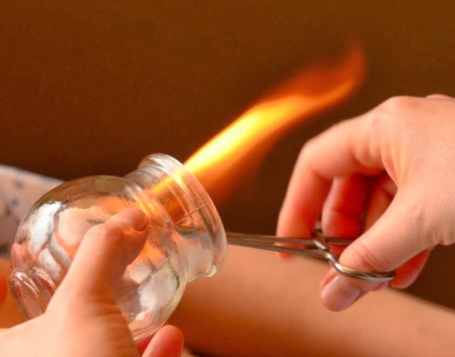 Hacamat nedir? Nasıl yapılır? Faydaları nelerdir? Zararları nelerdir?