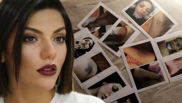 Eda Pera Küçük Kimdir | Kim Tarafından Darp Edildi