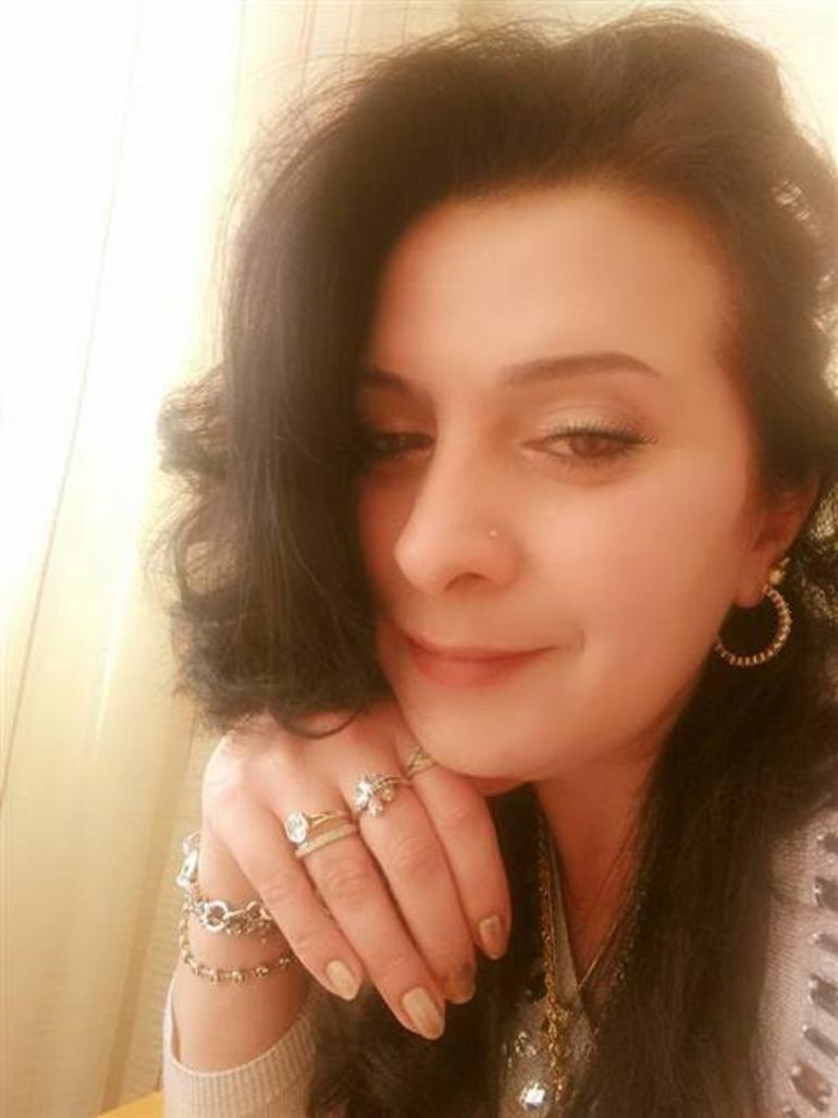 Dişlerini beyazlatmak isteyen kadın 32 dişinden oldu