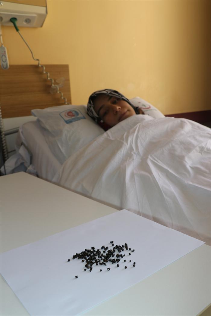 Safra kesesinden 200 tane taş çıktı!