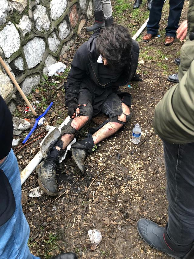 Bursa'da üniversite öğrencisine köpek saldırdı!