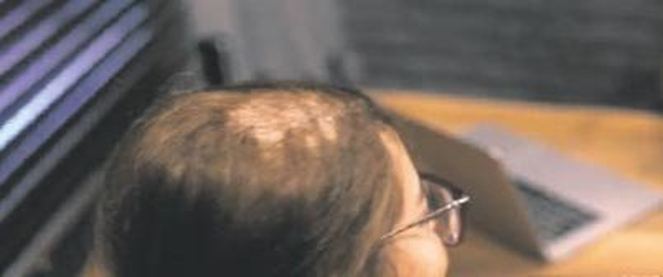 Buse Narcı 'nın saçları mı döküldü? Gerçekler ortaya çıktı!