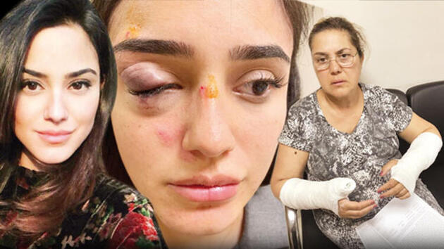 Ceren Kaplakarslan'ın zor anları! Annesi sevgilisi tarafından şiddet gördü