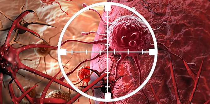 Kanser belirtileri nelerdir? Kanserin nedenleri nelerdir? Tüm tedavi yöntemleri
