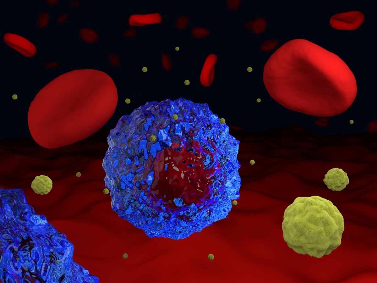 Kanser belirtileri nelerdir? Kanserin nedenleri nelerdir? Tüm tedavi yöntemleri
