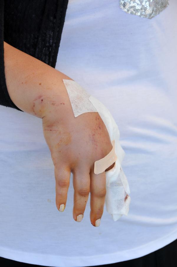 Antalya'da boşanmak isteyen kadın öldüresiye dayak yedi