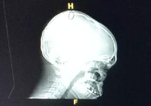 Bayram namazından çıktığı sırada kafasından vuruldu!