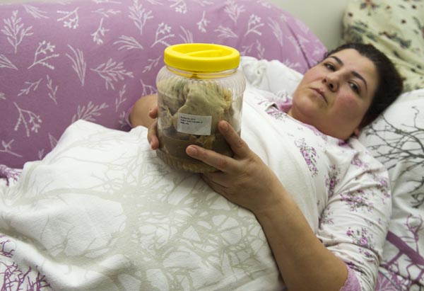 Kanser Diye Amaliyata Girdi İçinden Gazlı Bez Çıktı!